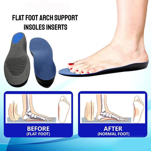 Orthotic Insoles for Arch Support Plantar Fasciitis Flat Feet Back & Heel Pain